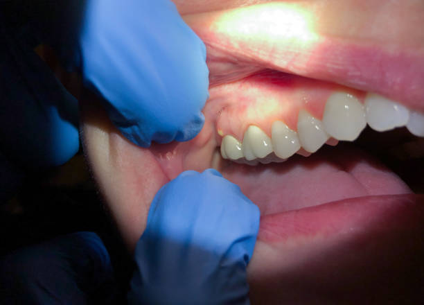 Best Emergency Dentist for Special Needs Patients in Columbus, GA